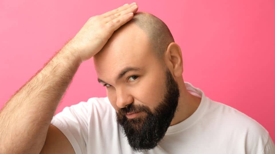 איך מבצעים השתלת שיער בפועל?